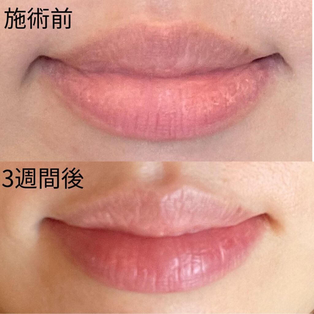 ローマピンク アフタークリーム ※LIP | Mahana.72