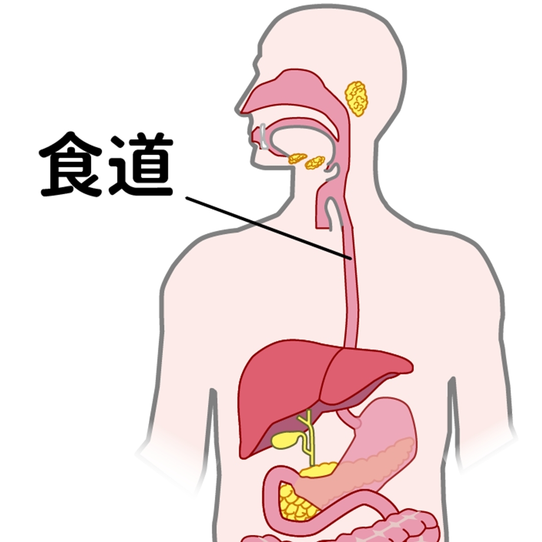 食道がんの4つの原因と初期症状とは?最も発見しやすいのは胃カメラ検査!